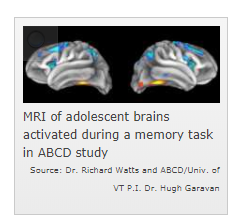 MRI of adolescent brains activated during a memory task in ABCD study. Source Dr. Richard Watts