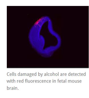 Cells damaged by alcohol are detected with red fluorescence in fetal mouse brain. 