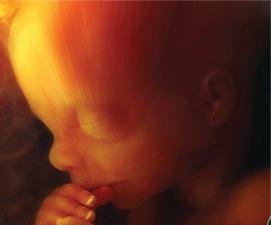 4D ultrasound of fetus