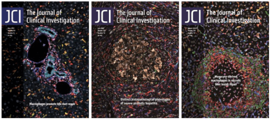 Three covers of the Journal of Clinical Investigation JCI with NIAAA research.