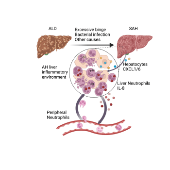 A diagram depicts an important role of self-sustaining IL-8+ neutrophils in promoting ALD to sAH transition by inducing inexorable inflammation in sAH.