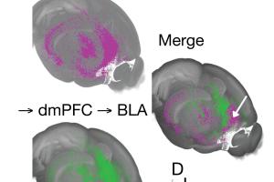 prefrontal cortex brain slide images